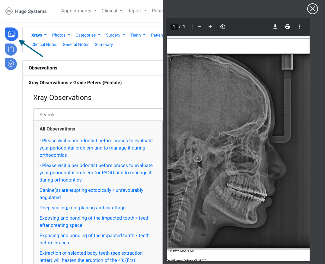 xray-panel